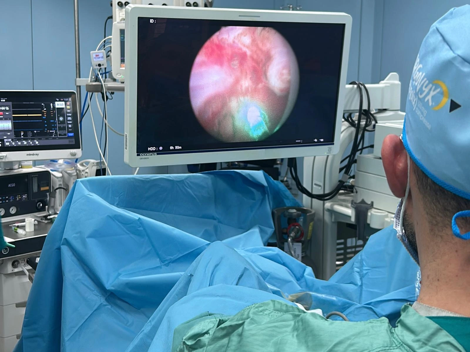 Enucleazione laser della prostata (HoLEP / ThuLEP) — Chirurgia laser endoscopica per l'ipertrofia prostatica benigna, senza incisioni e adatta a prostate di ogni dimensione.